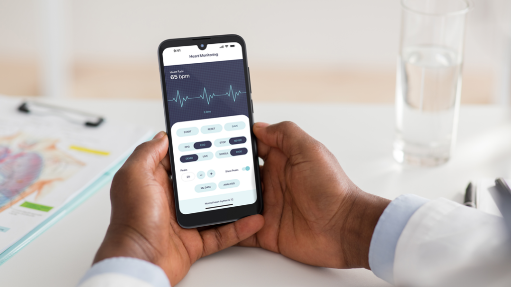 What Is Cardiac Rhythm Monitoring via Mobile Device?